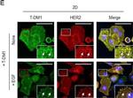 Mouse IgG (H+L) Highly Cross-Adsorbed Secondary Antibody in Immunocytochemistry (ICC/IF)