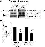 Phosphotyrosine Antibody in Western Blot (WB)