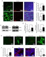 CD49b (Integrin alpha 2) Antibody in Immunohistochemistry (IHC)