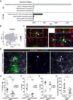 SMAD4 Antibody in Immunohistochemistry (IHC)