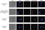 alpha Tubulin Antibody in Immunocytochemistry (ICC/IF)