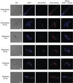 alpha Tubulin Antibody in Immunocytochemistry (ICC/IF)