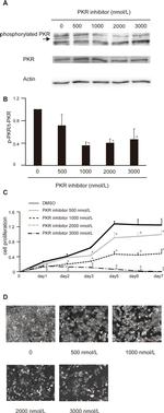 Phospho-PKR (Thr451) Antibody in Western Blot (WB)