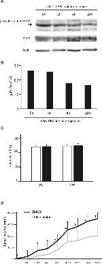 Phospho-PKR (Thr451) Antibody in Western Blot (WB)