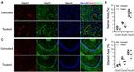 GLUT1 Antibody in Immunohistochemistry (IHC)