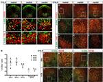 PITX3 Antibody in Immunohistochemistry (IHC)