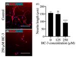 MAP2 Antibody in Immunocytochemistry (ICC/IF)