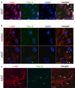 alpha Synuclein Antibody in Immunocytochemistry (ICC/IF)