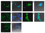 HERPUD1 Antibody in Immunocytochemistry (ICC/IF)