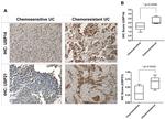 USP14 Antibody in Immunohistochemistry (IHC)