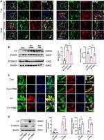 S100A10 Antibody in Western Blot, Immunocytochemistry (WB, ICC/IF)