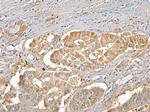 ALDH1A1 Antibody in Immunohistochemistry (IHC)