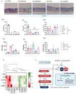 Cytokeratin 10 Antibody in Immunohistochemistry (IHC)