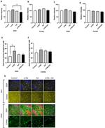 IBA1 Antibody in Immunohistochemistry (IHC)