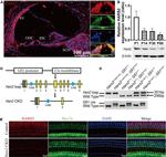 MYO7A Antibody in Immunohistochemistry (IHC)