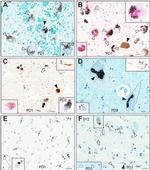 alpha Synuclein Antibody in Immunohistochemistry (IHC)