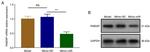 RAB3IP Antibody in Western Blot (WB)