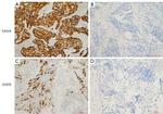 EGFR Antibody in Immunohistochemistry (IHC)