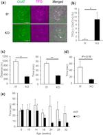 ChAT Antibody in Immunohistochemistry (IHC)