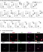 S100A4 Antibody in Immunocytochemistry (ICC/IF)