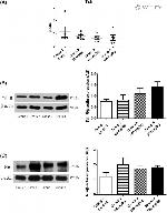 SLC5A5 Antibody in Western Blot (WB)