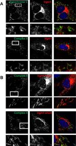 SDHA Antibody in Immunocytochemistry (ICC/IF)