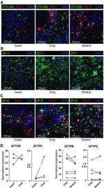 SFTPB Antibody in Immunohistochemistry (IHC)