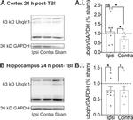 Ubiquilin 1 Antibody in Western Blot (WB)