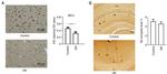 MCU Antibody in Immunohistochemistry (IHC)