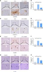 NLRP3 Antibody in Immunohistochemistry (IHC)