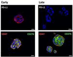 CD47 Antibody in Immunohistochemistry (Paraffin) (IHC (P))