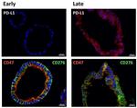 CD47 Antibody in Immunohistochemistry (Paraffin) (IHC (P))