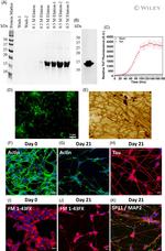 MAP2 Antibody in Immunocytochemistry (ICC/IF)