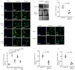 ADAMTS4 Antibody in Immunocytochemistry (ICC/IF)