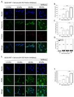 Filamin A Antibody in Immunocytochemistry (ICC/IF)