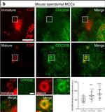 Mouse IgG1 Cross-Adsorbed Secondary Antibody in Immunocytochemistry (ICC/IF)