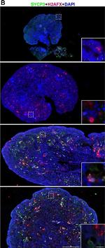 Mouse IgG (H+L) Highly Cross-Adsorbed Secondary Antibody in Immunohistochemistry (IHC)