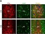 Goat IgG (H+L) Cross-Adsorbed Secondary Antibody in Immunohistochemistry (IHC)