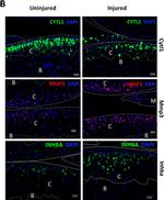 Rabbit IgG (H+L) Cross-Adsorbed Secondary Antibody in Immunohistochemistry (IHC)