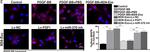 Mouse IgG (H+L) Highly Cross-Adsorbed Secondary Antibody in Immunocytochemistry (ICC/IF)