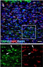 Donkey anti-Rabbit IgG (H+L) Highly Cross-Adsorbed, Alexa Fluor 