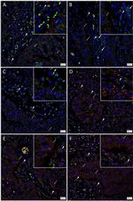 Rabbit IgG (H+L) Highly Cross-Adsorbed Secondary Antibody in Immunohistochemistry (IHC)