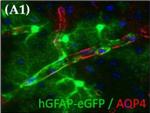 Rabbit IgG (H+L) Highly Cross-Adsorbed Secondary Antibody in Immunohistochemistry (IHC)