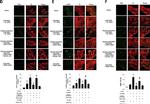 Rabbit IgG (H+L) Highly Cross-Adsorbed Secondary Antibody in Immunohistochemistry (IHC)