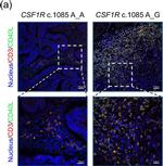 Mouse IgG (H+L) Highly Cross-Adsorbed Secondary Antibody in Immunohistochemistry (Paraffin) (IHC (P))