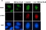 Mouse IgG1 Cross-Adsorbed Secondary Antibody in Immunocytochemistry (ICC/IF)