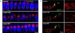 Rabbit IgG (H+L) Highly Cross-Adsorbed Secondary Antibody in Immunohistochemistry (IHC)