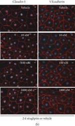 Rabbit IgG (H+L) Cross-Adsorbed Secondary Antibody in Immunocytochemistry (ICC/IF)