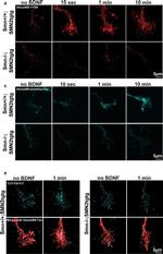 Mouse IgG (H+L) Highly Cross-Adsorbed Secondary Antibody in Immunocytochemistry (ICC/IF)