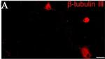 Mouse IgG (H+L) Highly Cross-Adsorbed Secondary Antibody in Immunocytochemistry (ICC/IF)